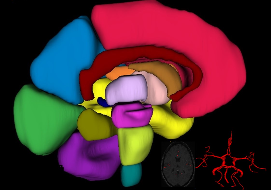 MRI Annotation