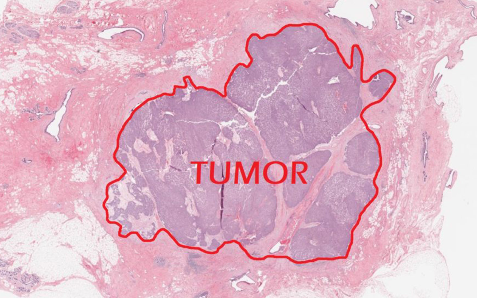 DIGITAL PATHOLOGY