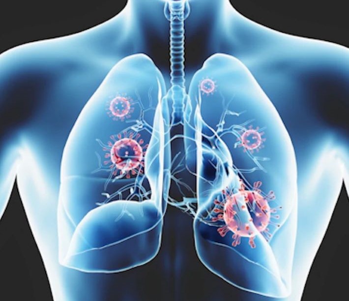 ABNORMALITIES DETECTION