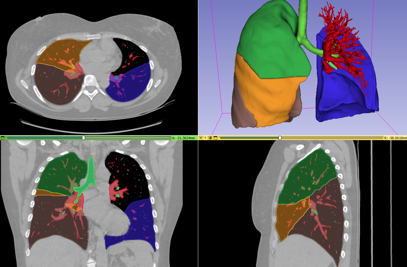 3D SEGMENTATION