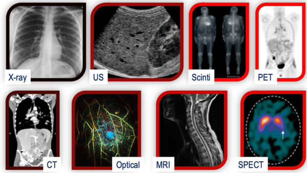 Public and Hospital-Own Training Datasets for AI